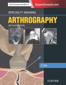 Specialty Imaging: Arthrography E-Book : Specialty Imaging: Arthrography E-Book