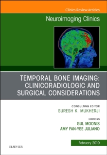 Temporal Bone Imaging: Clinicoradiologic and Surgical Considerations, An Issue of Neuroimaging Clinics of North America, Hardback Book Temporal Bone Imaging: Clinicoradiologic and Surgical Considerations, An Issue of Neuroimaging Clinics of North America, Hardback Book