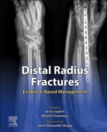 Distal Radius Fractures : Evidence-Based Management