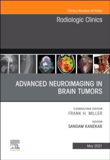 Advanced Neuroimaging in Brain Tumors, An Issue of Radiologic Clinics of North America : Volume 59-3