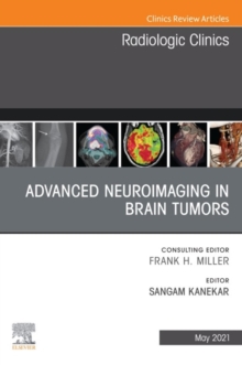 Advanced Neuroimaging in Brain Tumors, An Issue of Radiologic Clinics of North America, E-Book : Advanced Neuroimaging in Brain Tumors, An Issue of Radiologic Clinics of North America, E-Book