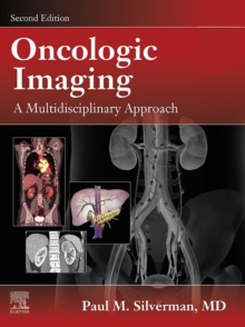 Oncologic Imaging: A Multidisciplinary Approach : Expert Consult - Online and Print