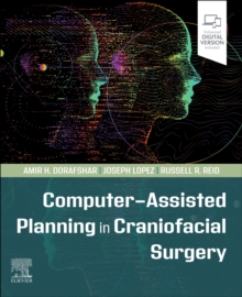 Computer-Assisted Planning in Craniofacial Surgery