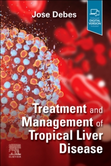 Treatment and Management of Tropical Liver Disease