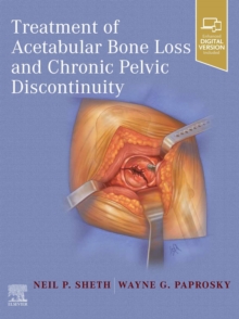 Treatment of Acetabular Bone Loss and Chronic Pelvic Discontinuity