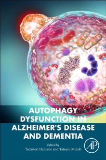 Autophagy Dysfunction in Alzheimer's Disease and Dementia