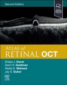 Atlas of Retinal OCT : Optical Coherence Tomography