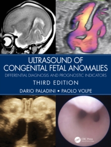 Ultrasound of Congenital Fetal Anomalies : Differential Diagnosis and Prognostic Indicators