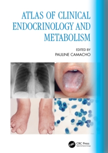 Atlas of Clinical Endocrinology and Metabolism