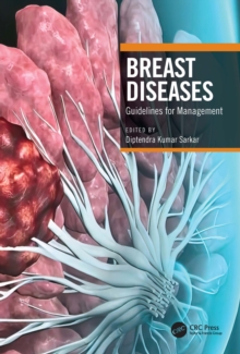 Breast Diseases : Guidelines for Management