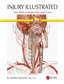 Injury Illustrated : How Medical Images Win Legal Cases