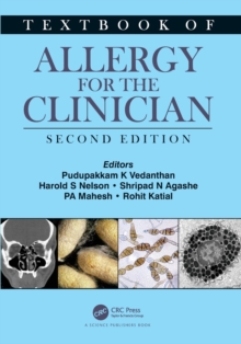 Textbook of Allergy for the Clinician