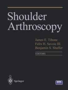 Shoulder Arthroscopy