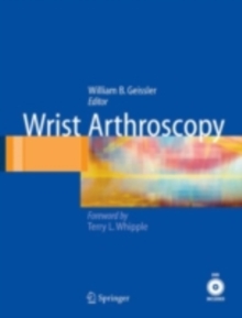 Wrist Arthroscopy