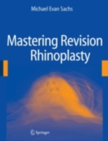 Mastering Revision Rhinoplasty