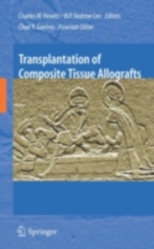 Transplantation of Composite Tissue Allografts