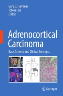 Adrenocortical Carcinoma : Basic Science and Clinical Concepts