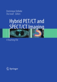 Hybrid PET/CT and SPECT/CT Imaging : A Teaching File