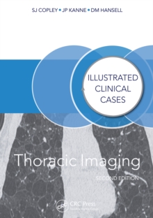 Thoracic Imaging : Illustrated Clinical Cases, Second Edition