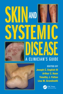 Skin and Systemic Disease : A Clinician's Guide