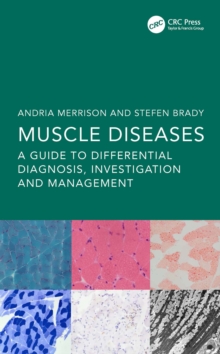 Muscle Diseases : A Guide to Differential Diagnosis, Investigation and Management