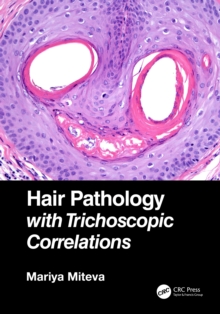 Hair Pathology with Trichoscopic Correlations