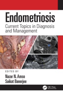 Endometriosis : Current Topics in Diagnosis and Management