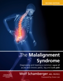 The Malalignment Syndrome : diagnosis and treatment of common pelvic and back pain