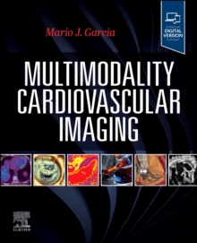 Multimodality Cardiovascular Imaging