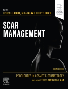 Scar Management - E-BOOK