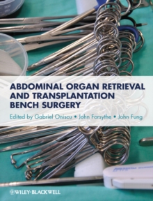 Abdominal Organ Retrieval and Transplantation Bench Surgery, Hardback Book Abdominal Organ Retrieval and Transplantation Bench Surgery, Hardback Book
