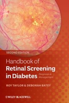 Handbook of Retinal Screening in Diabetes : Diagnosis and Management, Paperback / softback Book Handbook of Retinal Screening in Diabetes : Diagnosis and Management, Paperback / softback Book
