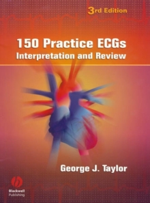 150 Practice ECGs : Interpretation and Review