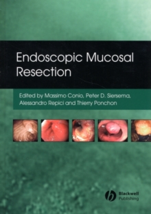 Endoscopic Mucosal Resection