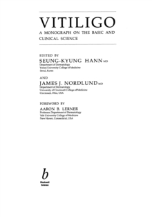 Vitiligo : A Monograph on the Basic and Clinical Science