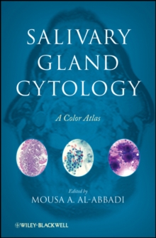 Salivary Gland Cytology : A Color Atlas