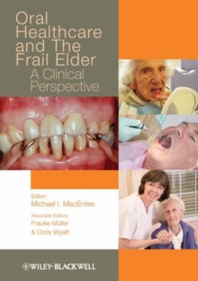 Oral Healthcare and the Frail Elder : A Clinical Perspective