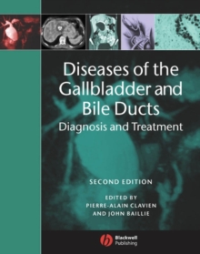 Diseases of the Gallbladder and Bile Ducts : Diagnosis and Treatment