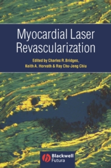 Myocardial Laser Revascularization