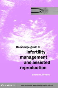 Cambridge Guide to Infertility Management and Assisted Reproduction