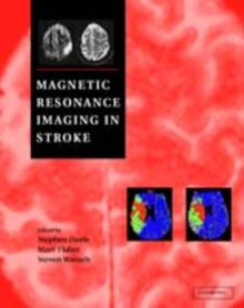 Magnetic Resonance Imaging in Stroke