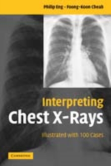 Interpreting Chest X-Rays : Illustrated with 100 Cases