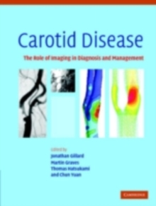 Carotid Disease : The Role of Imaging in Diagnosis and Management