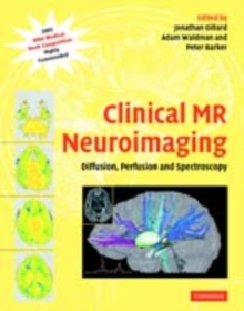 Clinical MR Neuroimaging : Diffusion, Perfusion and Spectroscopy