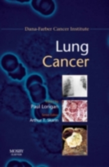 Lung Cancer