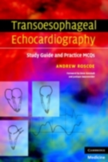 Transoesophageal Echocardiography : Study Guide and Practice MCQs