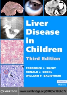 Liver Disease in Children