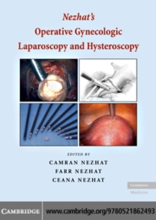 Nezhat's Operative Gynecologic Laparoscopy and Hysteroscopy