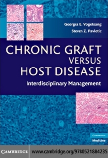 Chronic Graft Versus Host Disease : Interdisciplinary Management