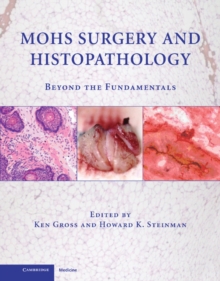 Mohs Surgery and Histopathology : Beyond the Fundamentals